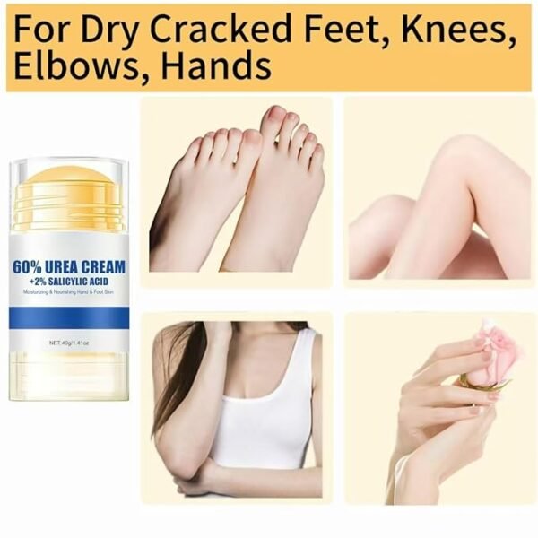 60% Urea Plus 2% Salicylic-Acid Foot Cream,Hydrating and Anti-Cracking Foot Cream,Heel Balm Stick,Deep Moisturizing Nourish Foot Care for Dry Cracked Feet,Soften&Smoothing Skin - Image 5